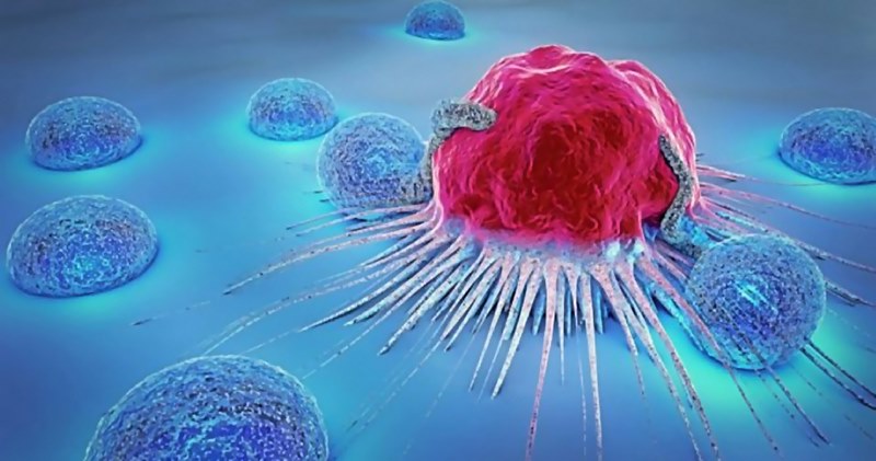 Что такое рак: причины, основные симптомы и лечение онкологии